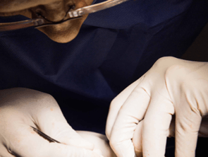 Cirugía Oftalmológica